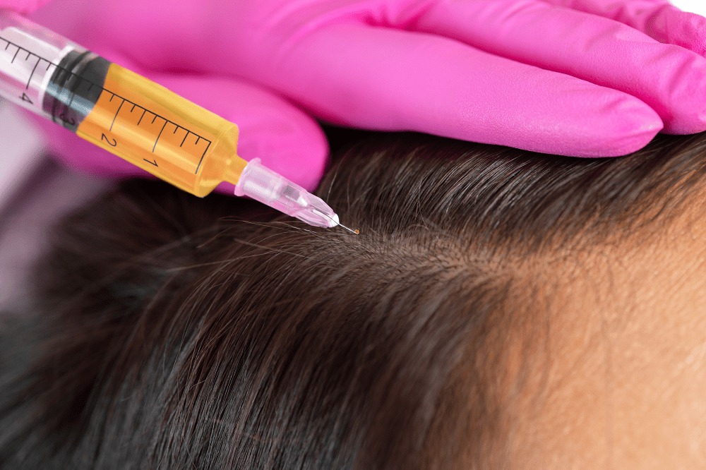 Botoks włosów – czym jest i jaki jest koszt takiego zabiegu?